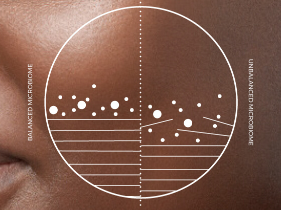 Close-up of skin with an overlaid diagram showing balanced and unbalanced microbiomes. White circles and lines on the left indicate a balanced microbiome, while more circles and uneven lines on the right indicate an unbalanced microbiome.